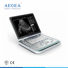 АГ-BU007 ноутбука больнице портативный медицинский аппарат для УЗИ 